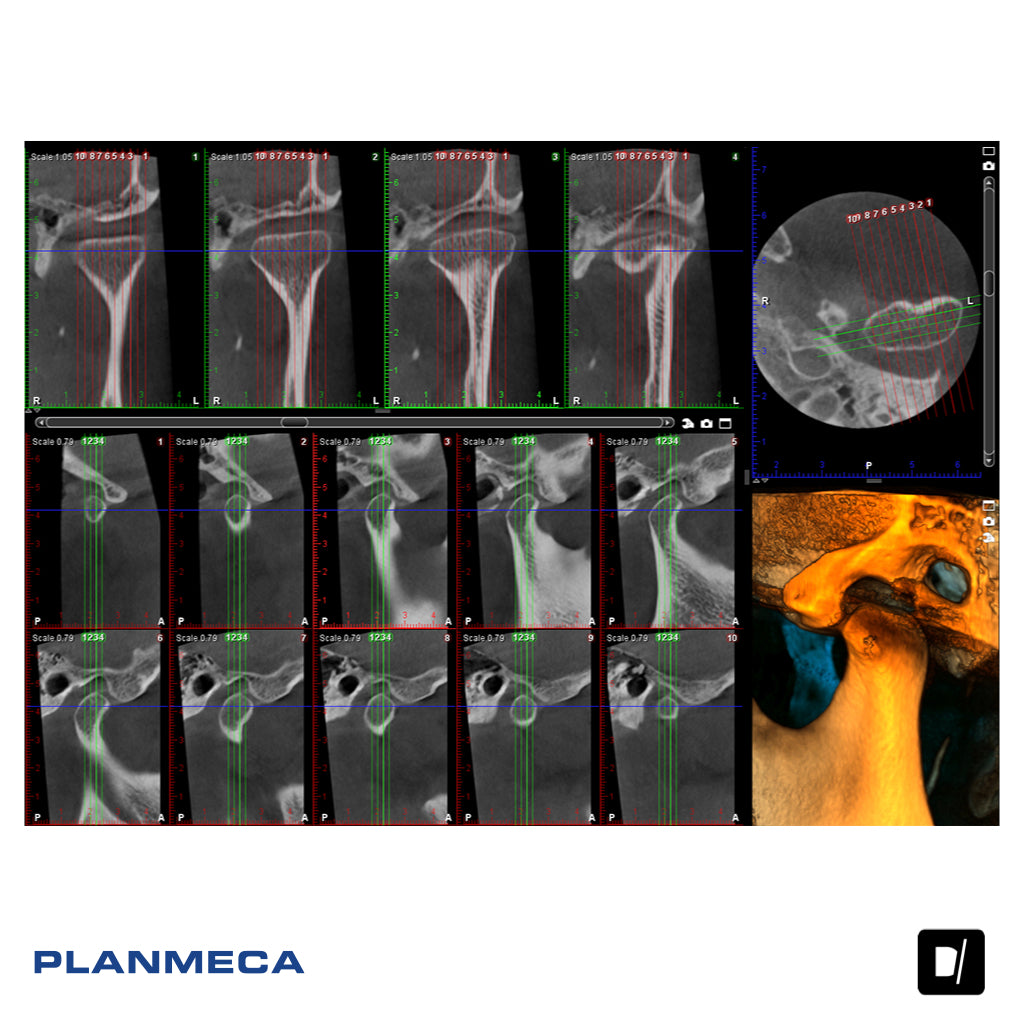 Tomógrafo Dental (CBCT) - Planmeca Promax 3D Classic