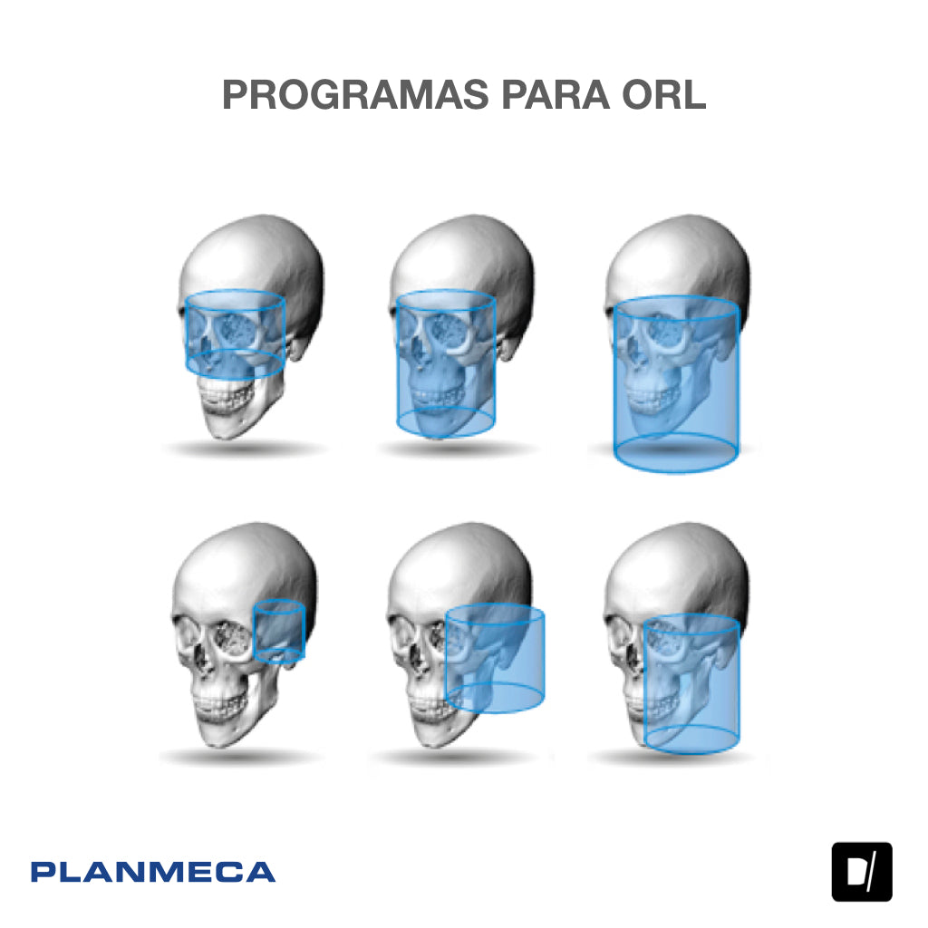 Tomógrafo Dental-Maxilofacial (CBCT) - Planmeca Promax 3D Plus