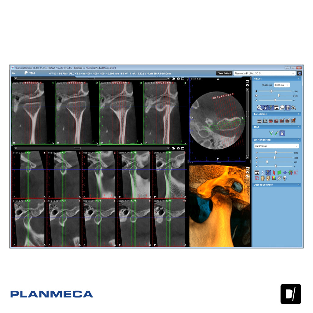 Tomógrafo Dental-Maxilofacial (CBCT) - Planmeca Promax 3D Plus
