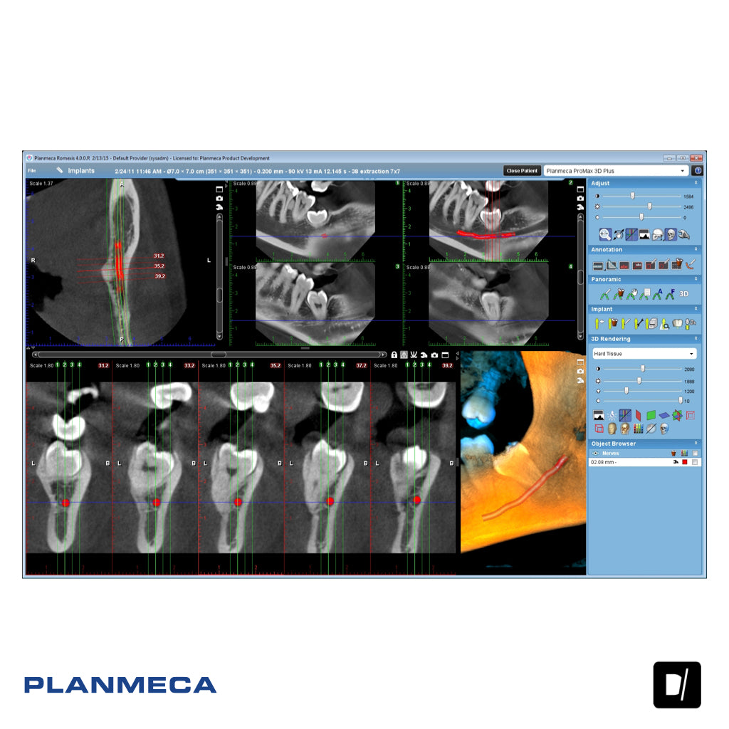 Tomógrafo Dental-Maxilofacial (CBCT) - Planmeca Promax 3D Plus