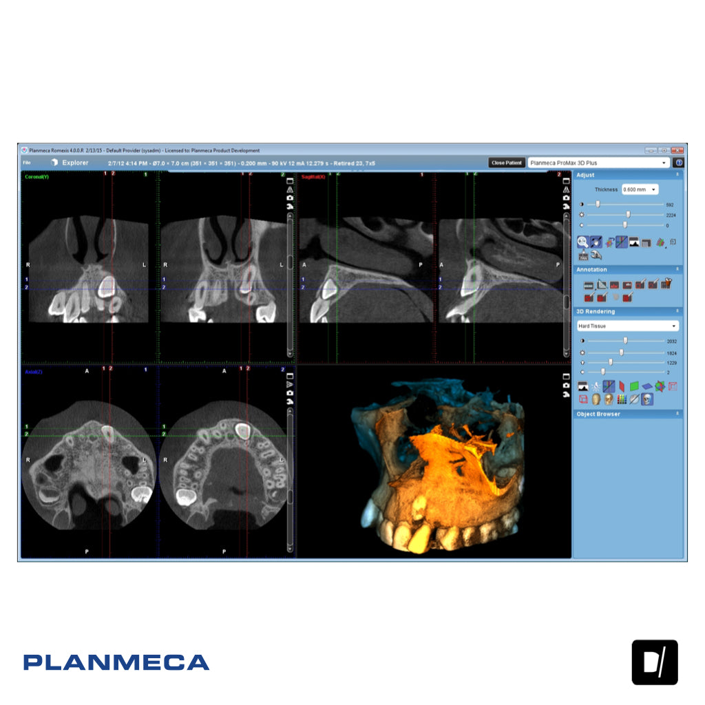 Tomógrafo Dental-Maxilofacial (CBCT) - Planmeca Promax 3D Plus