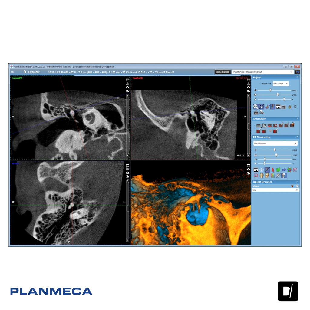 Tomógrafo Dental-Maxilofacial (CBCT) - Planmeca Promax 3D Plus