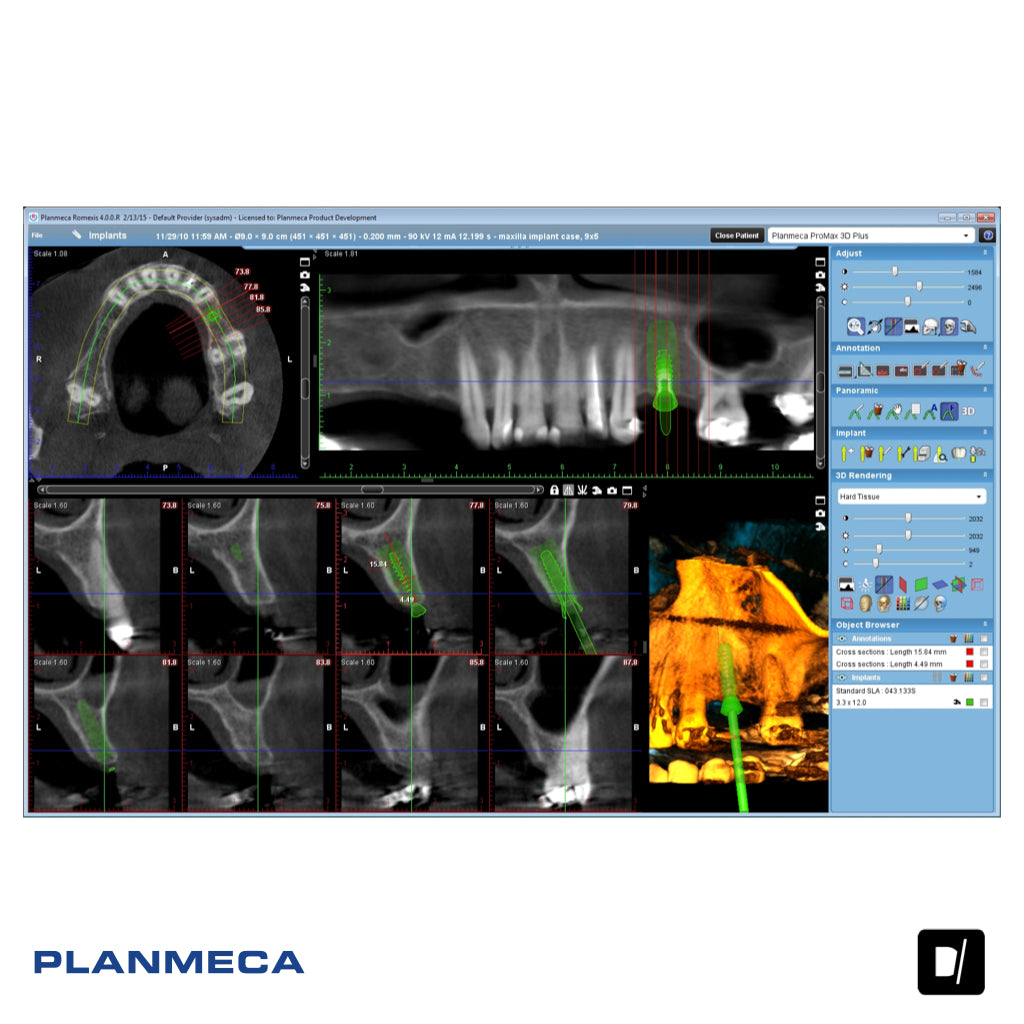 Tomógrafo Dental-Maxilofacial (CBCT) - Planmeca Promax 3D Plus