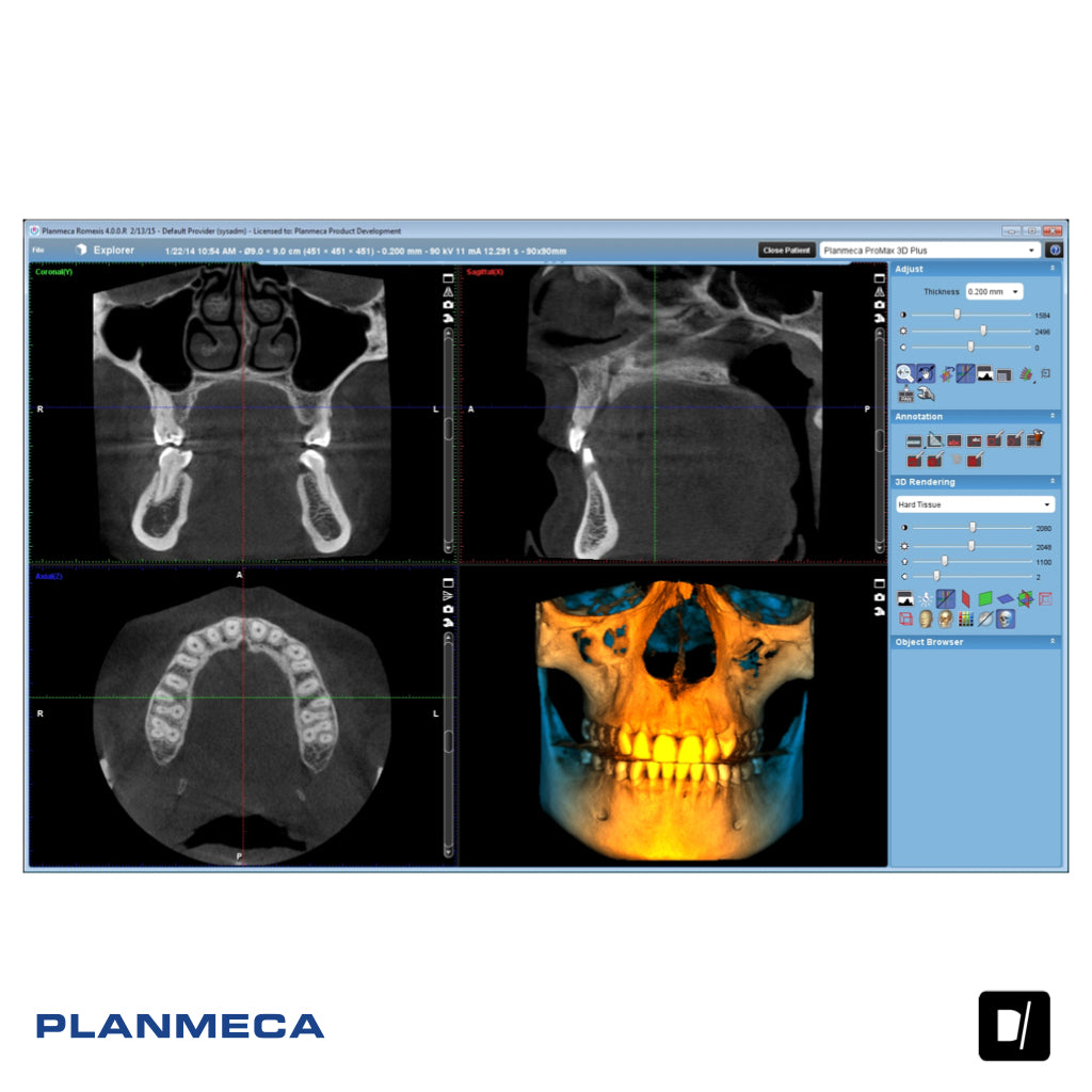 Tomógrafo Dental-Maxilofacial (CBCT) - Planmeca Promax 3D Plus