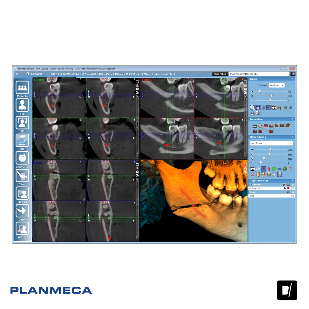 Tomógrafo Dental-Maxilofacial (CBCT) - Planmeca Promax 3D Mid