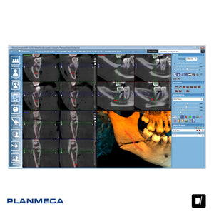 Tomógrafo Dental-Maxilofacial (CBCT) - Planmeca Promax 3D Mid