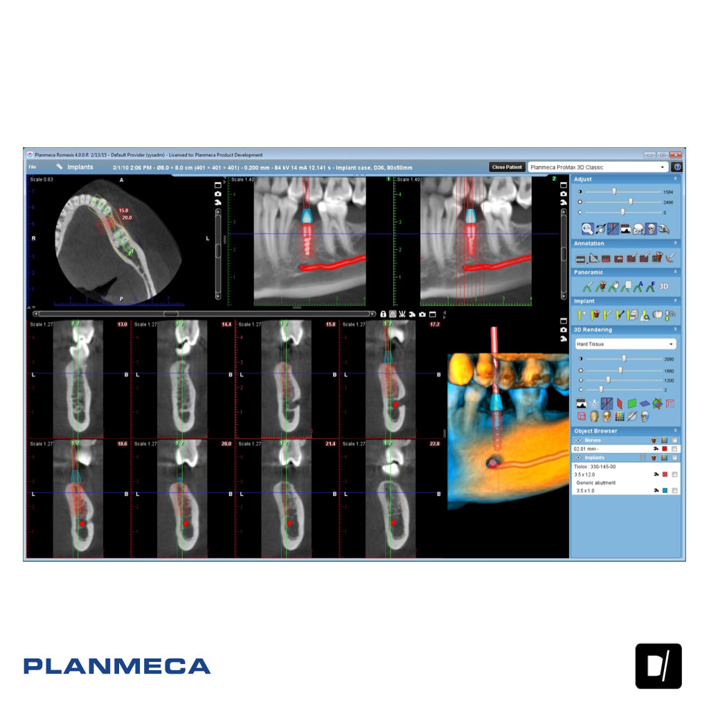 Tomógrafo Dental (CBCT) - Planmeca Promax 3D Classic
