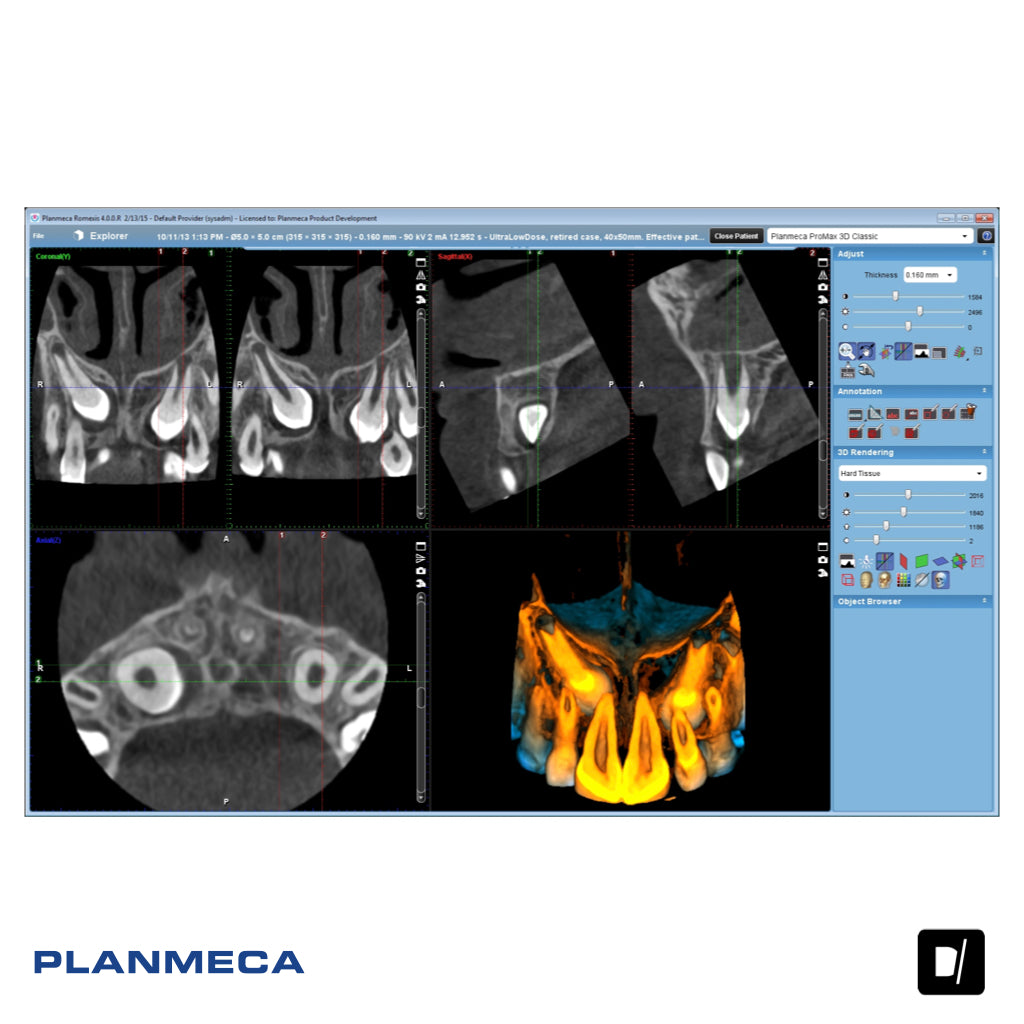 Tomógrafo Dental (CBCT) - Planmeca Promax 3D Classic