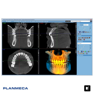 Tomógrafo Dental (CBCT) - Planmeca Promax 3D Classic