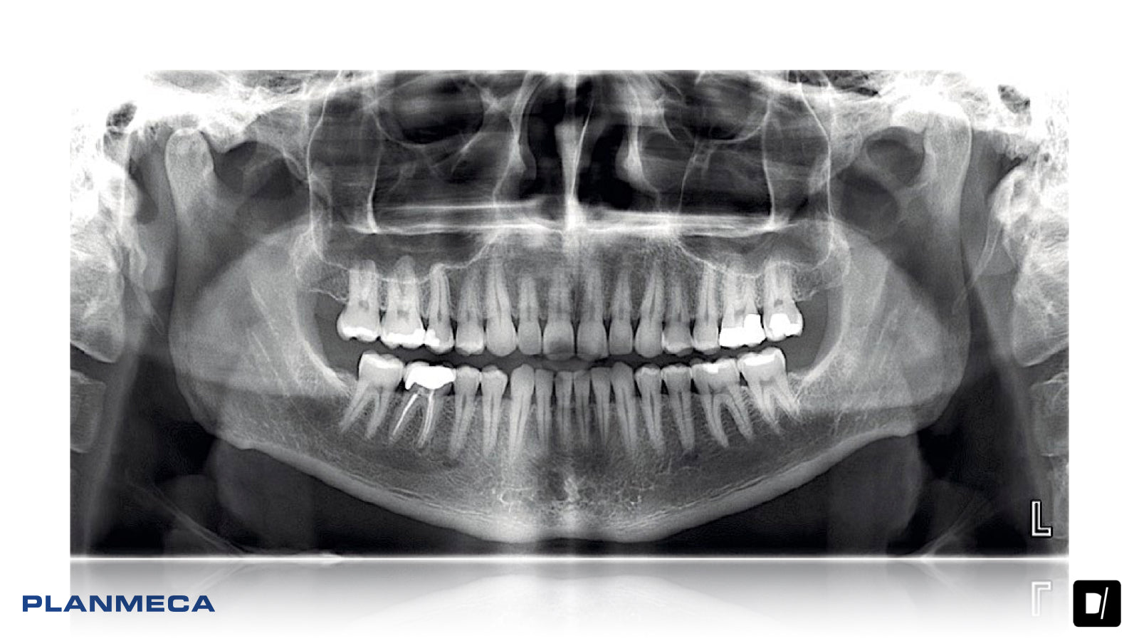 Panoramico Dental - Planmeca Promax 2D