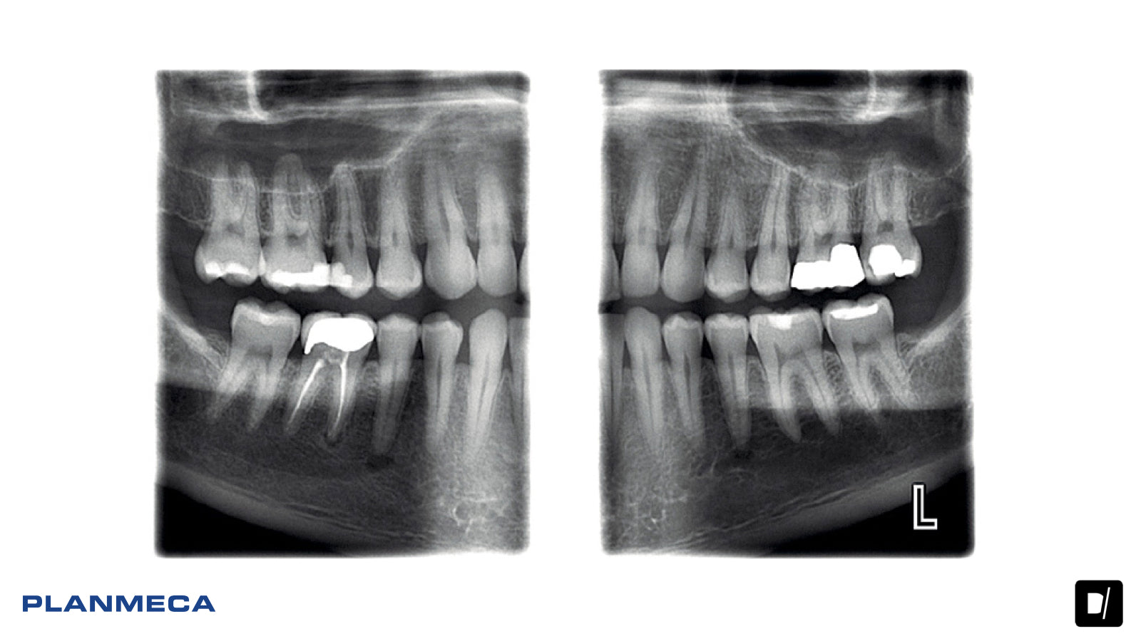 Panoramico Dental - Planmeca Promax 2D
