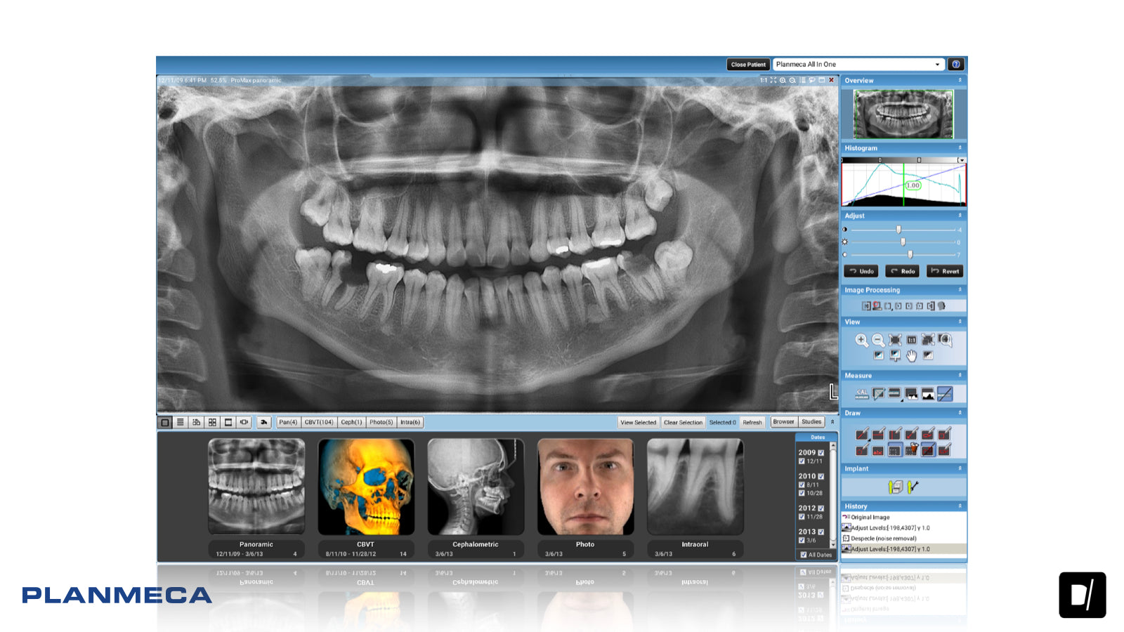 Panoramico Dental - Planmeca Promax 2D